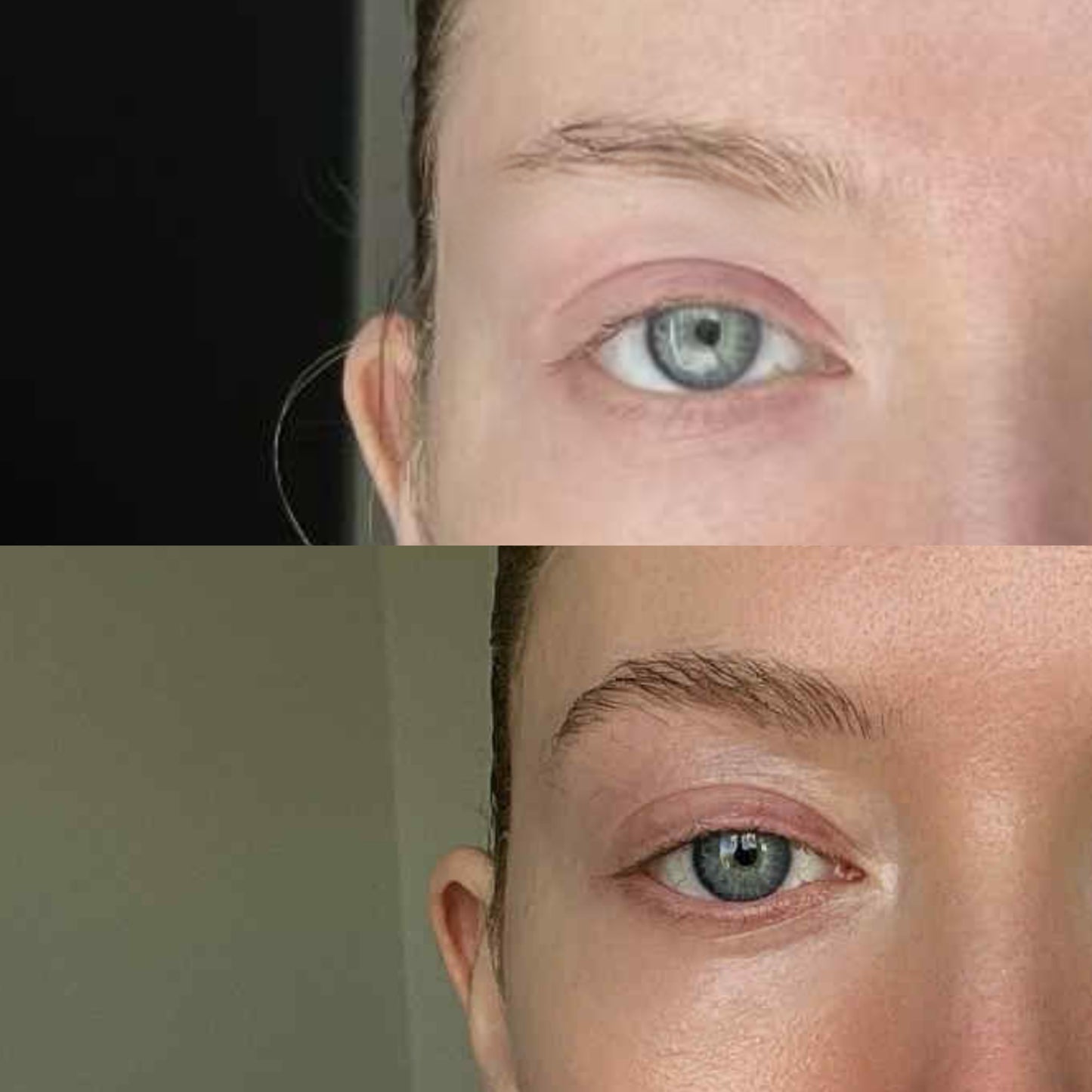 MREVIVE HydraBrow